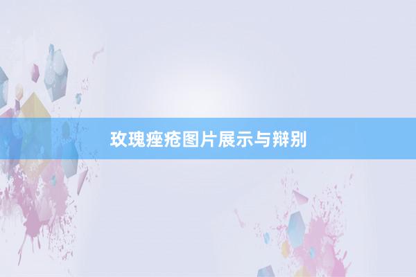玫瑰痤疮图片展示与辩别